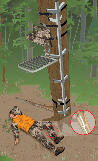 Illustration of injured hunter lying on the ground, who fell from a tree stand and who was not wearing an FAS